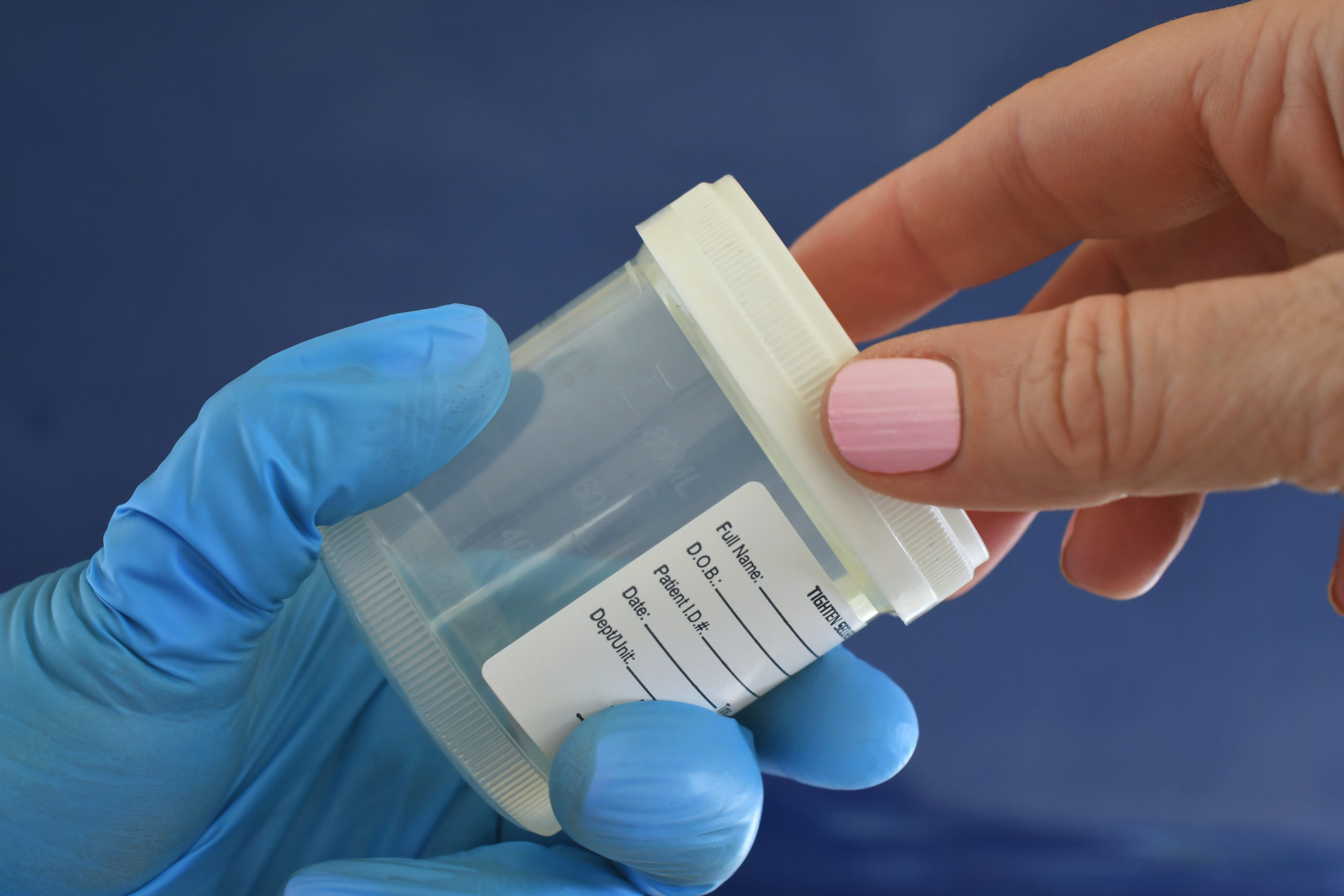 Do I Have to Take a Drug Test if I Get Hurt at Work in Rogers, Arkansas?